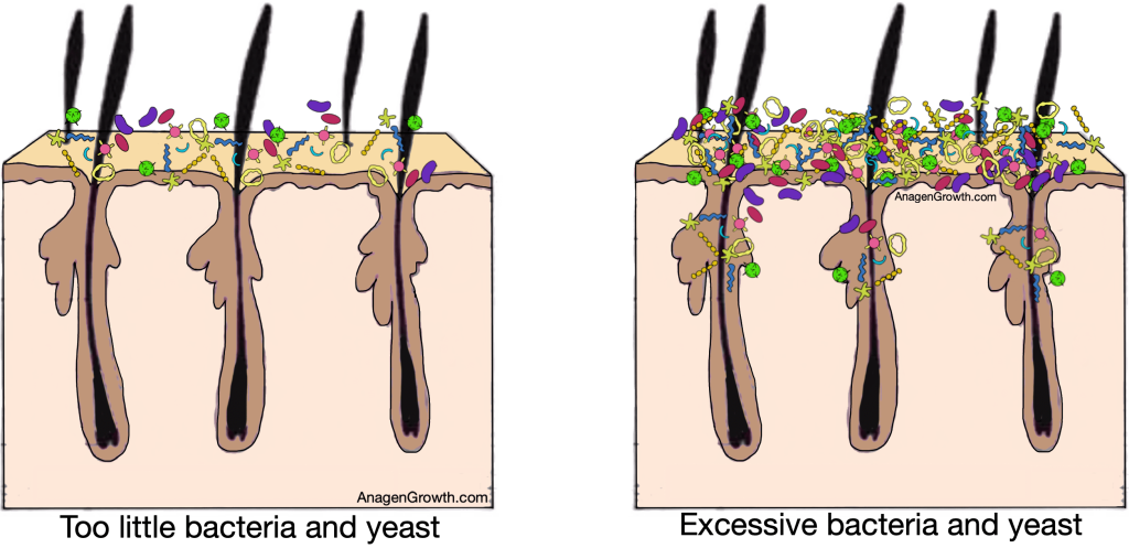 scalp microbiome comparison for ketoconazole shampoo usage